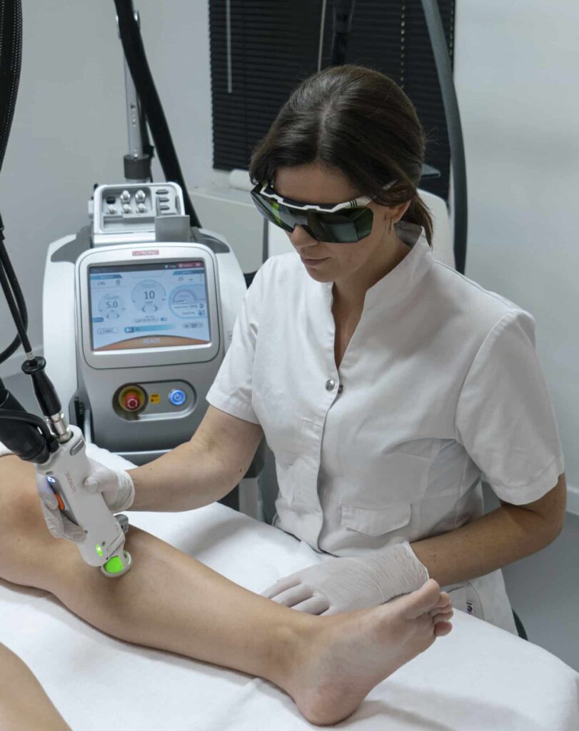 laserontharing behandeling van benen met het clarity 2 toestel van lutronic