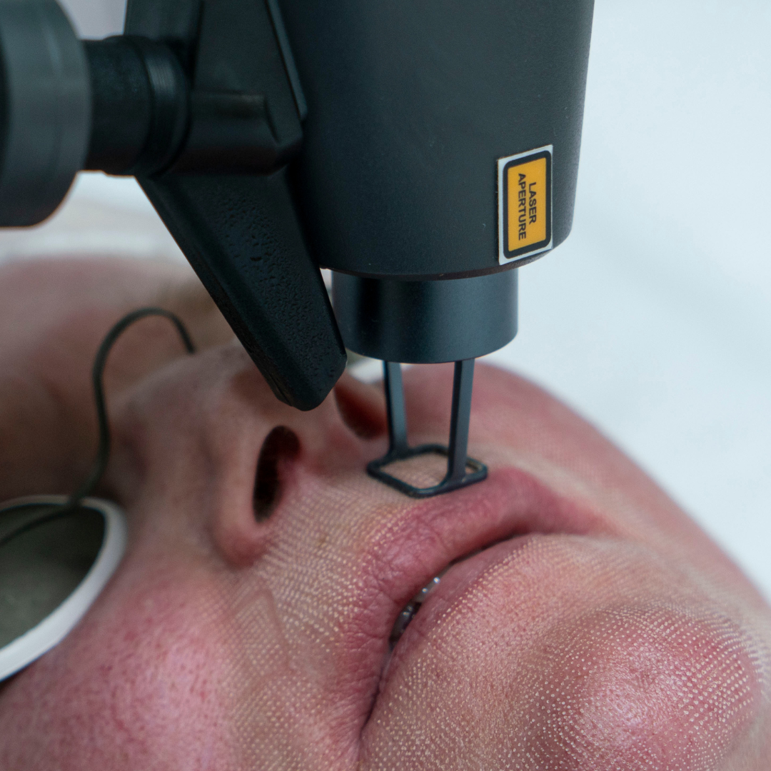 traitement au laser yag