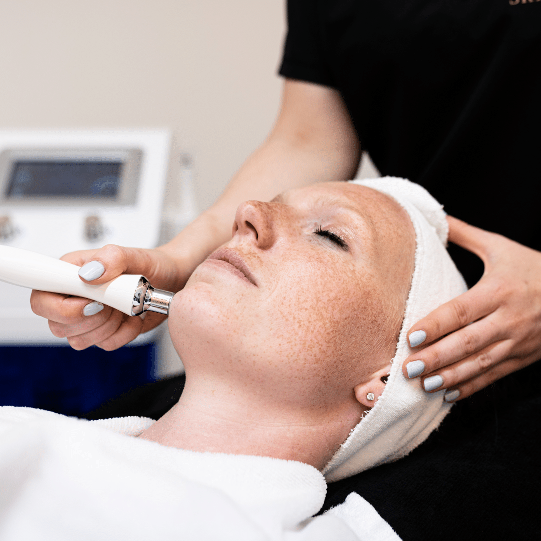 hydrodermabrasion